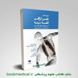 صفر تا صد تفسيرگرافي قفسه سينه